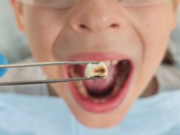 Best Cosmetic Emergency Dentistry in Cedar Bluff, VA